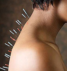 Un-scurt-ghid-despre-acupunctura