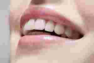 Ce este estetica dentara?