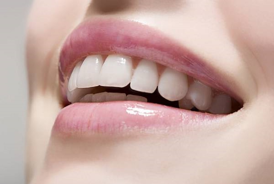 Ce este estetica dentara?